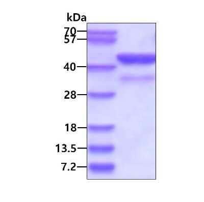 SDS-PAGE: Recombinant Human Cyclophilin 40 His Protein [NBC1-18427]